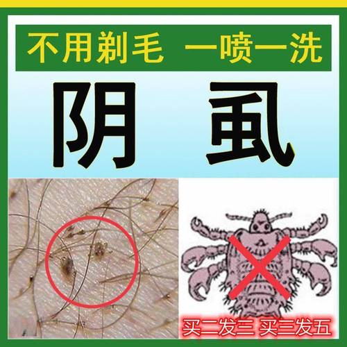 虱子怎么去除?虱子怎么去除最快方法!